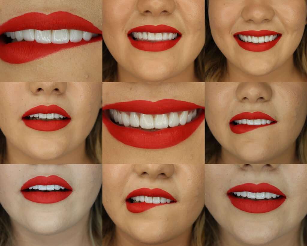 fatete dentare clinica dentara Cluj - Offident