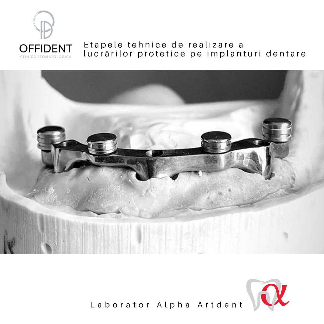 Obținerea modelului de gips