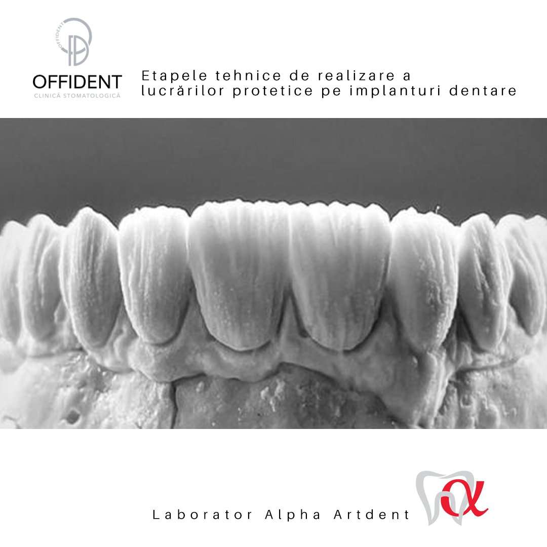 ceramica dentara Cluj